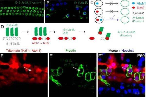 毛细胞再生最新消息,“前沿动态：毛细胞再生研究取得突破性进展！”