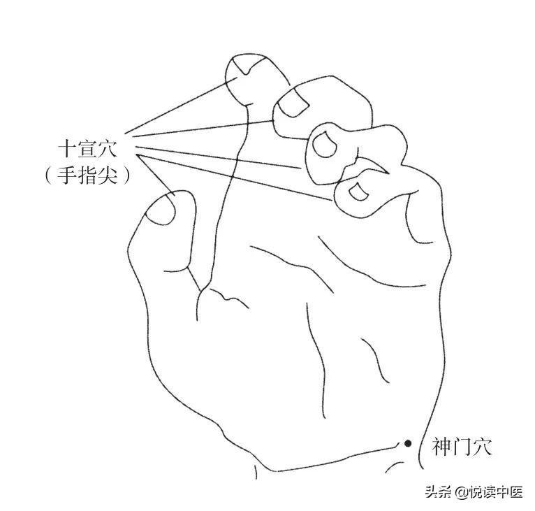 耳鸣最新疗法,“前沿科技引领耳鸣治疗新突破”