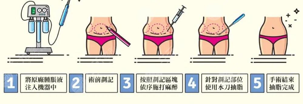 最新吸脂手术方法,最新脂肪溶解技术